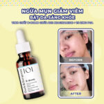 vn-11134201-81ztc-mmli0o8ry9kx49