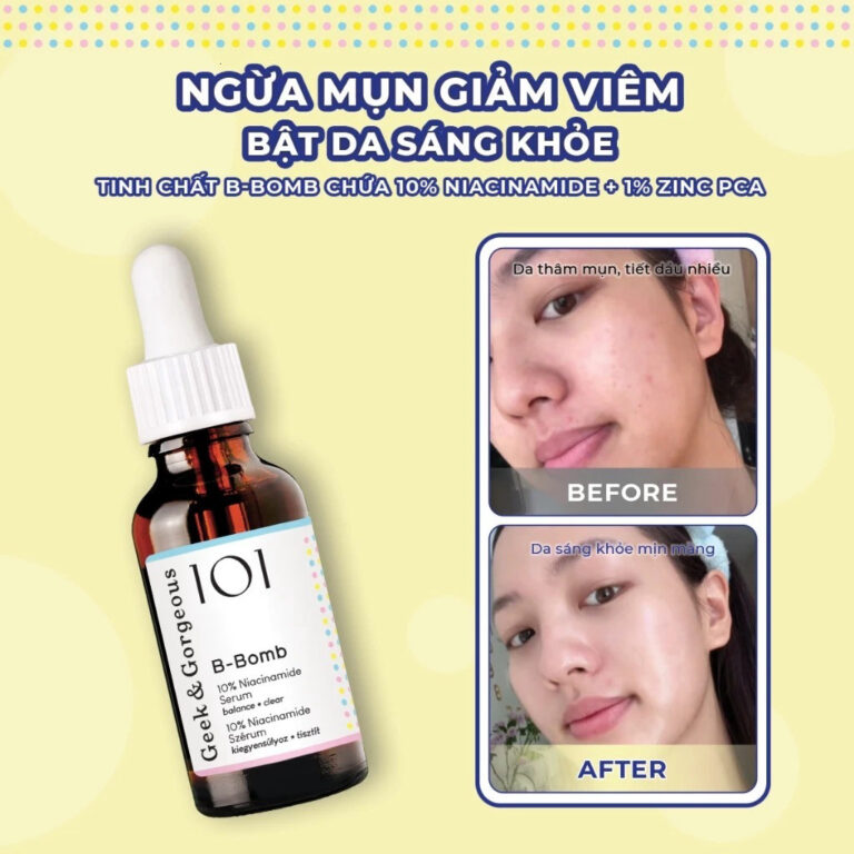 Tinh Chất Kiềm Dầu, Hỗ Trợ Kháng Viêm, Cải Thiện Mụn Geek & Gorgeous B-Bomb 10% Niacinamide 30ml
