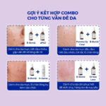 vn-11134201-81ztc-mmli0te3wruu32
