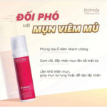 vn-11134201-81ztc-mmlir7zf1dzj5c