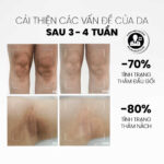 vn-11134201-81ztc-mmll3nw2qt4x10