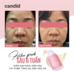 vn-11134207-7ras8-matcx2o13qhj83
