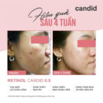vn-11134207-7ras8-matcx2o1551z72