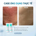 vn-11134207-81ztc-mmrcc1lz6a6de7