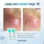 vn-11134207-81ztc-mmrcc1mdt154ea